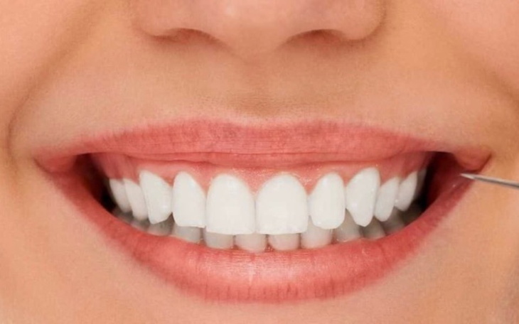 Zbiórka Zbieram Na nowyy piękny uśmiech - zdjęcie główne