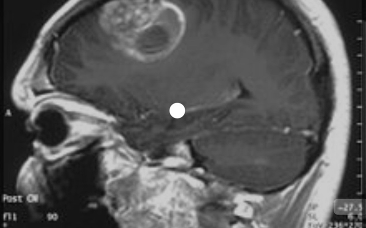 Zbiórka Glejak Zabija mi tatę - zdjęcie główne