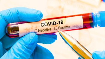 Zbiórka Zbiórka na koronawirusa - miniaturka zdjęcia