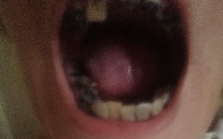 Zbiórka Chcę wkoncu normalnie jeść - zdjęcie główne