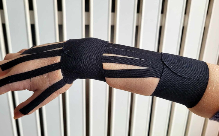 Zabandażowana ręka z elastycznym materiałem.