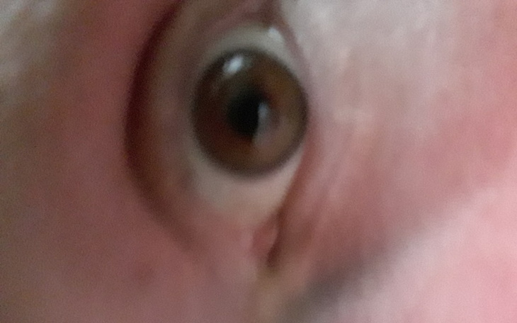 Zbiórka Eutanazja PL - zdjęcie główne