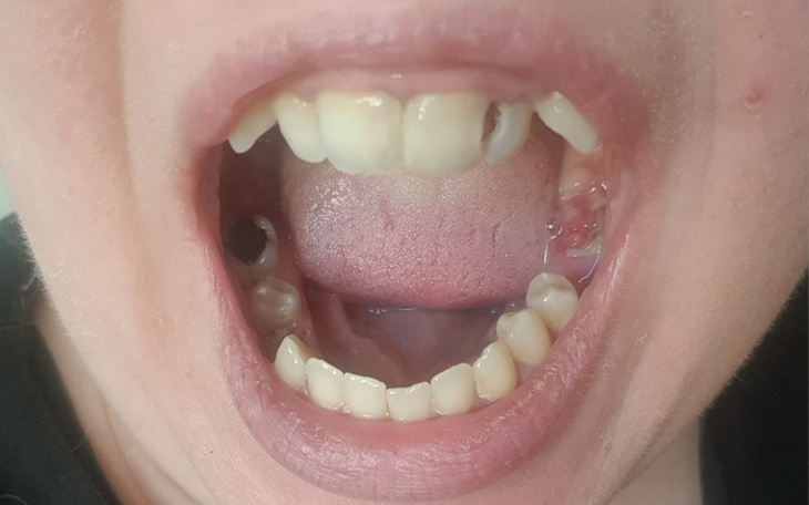 Zbiórka Bardzo chore zeby - zdjęcie główne