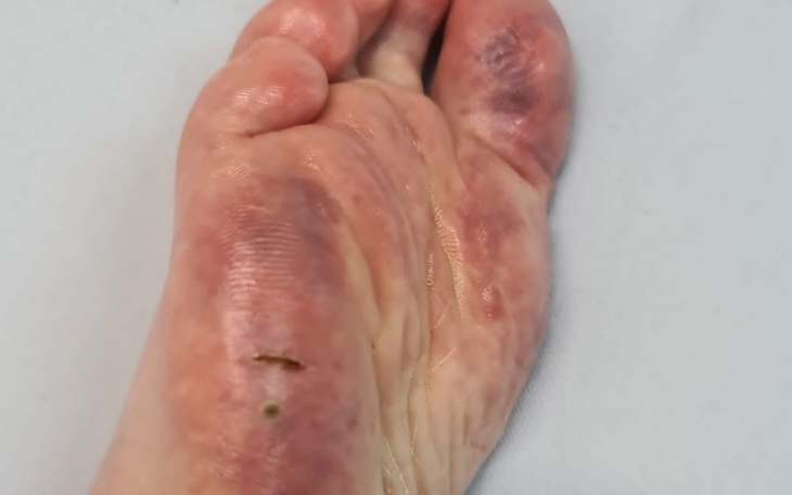 Zbiórka Toczeń walka - zdjęcie główne