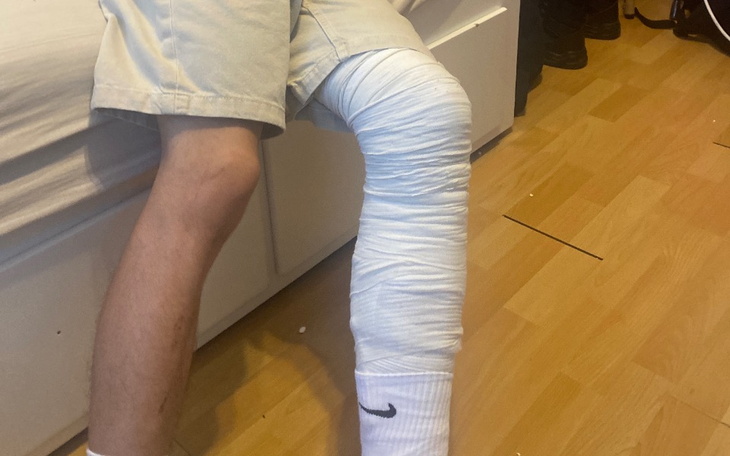 Zbiórka Skręcona rzepka rehabilitacja - zdjęcie główne