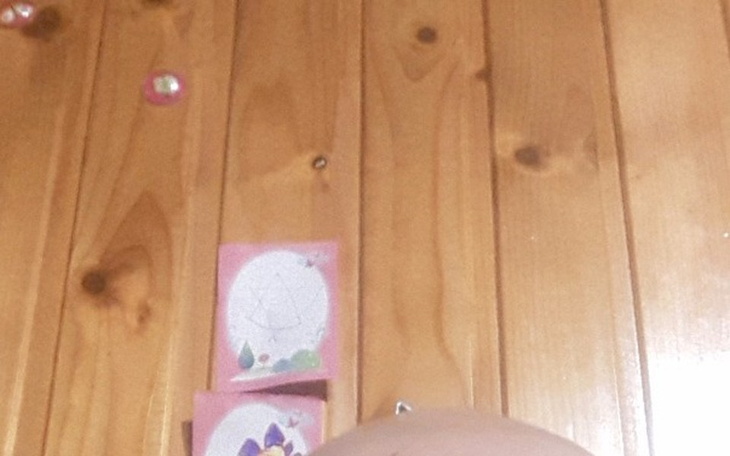 Zbiórka Chłoniak Hodgkina Ann Arbor IV B - zdjęcie główne