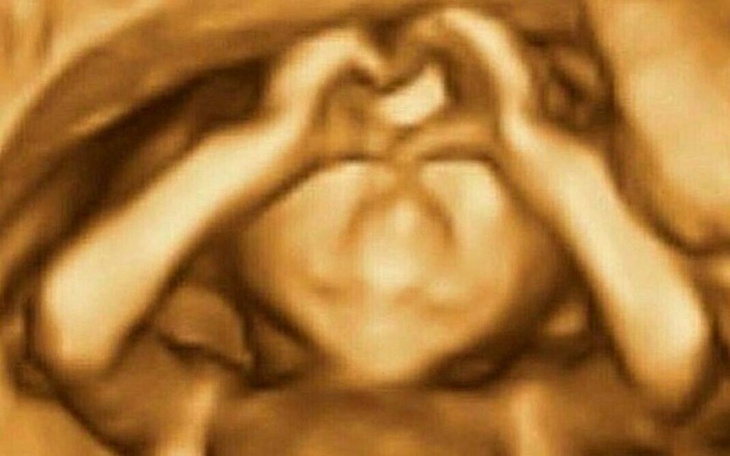 Zbiórka Zbieram na pokoik dla dziecka - zdjęcie główne