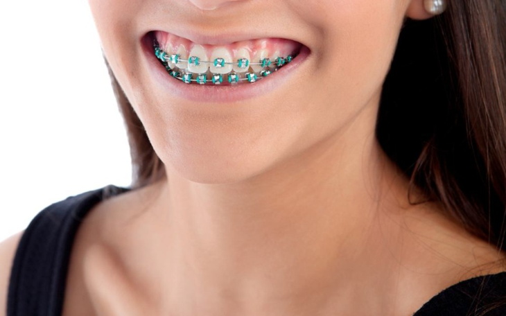 Zbiórka Aparat stały dla córki - zdjęcie główne