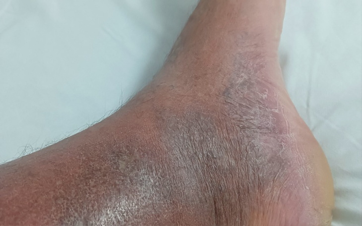 Zbiórka Na naprawę nogi - zdjęcie główne