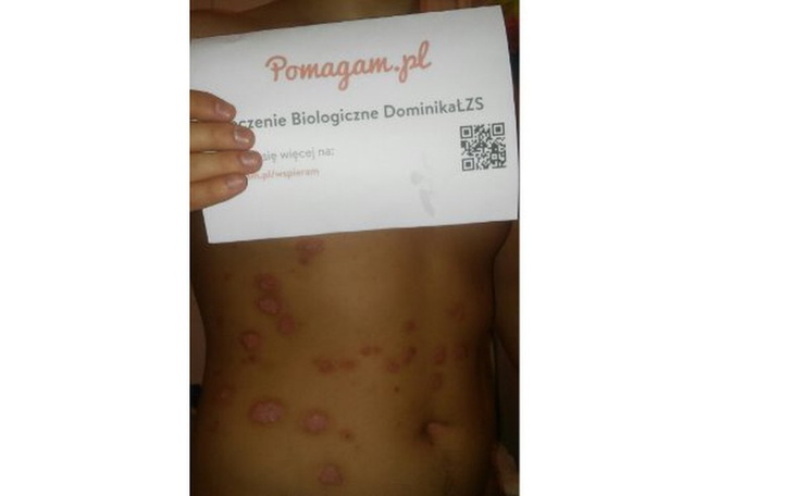 Zbiórka Leczenie Biologiczne DominikaŁZS - zdjęcie główne