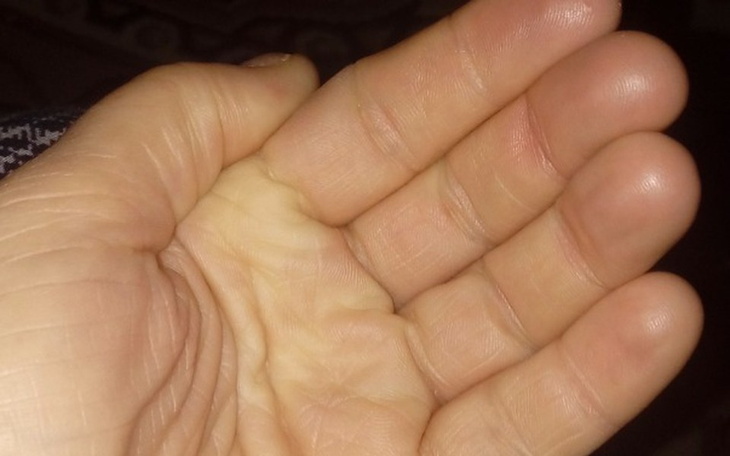 Zbiórka Pomoc w krytycznej sytuacji - zdjęcie główne