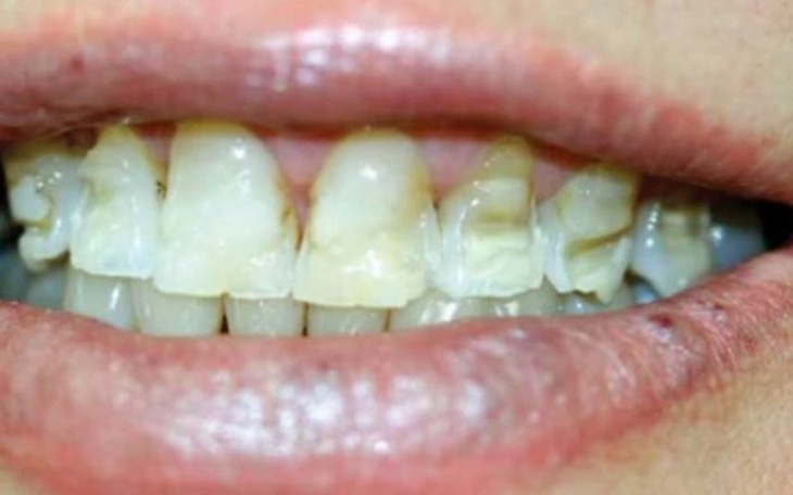 Zbiórka nowy UŚMIECH na zdrowie - zdjęcie główne