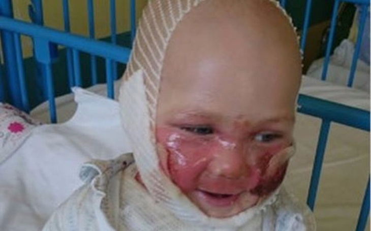 Zbiórka Pomoc dla Hanusi - zdjęcie główne