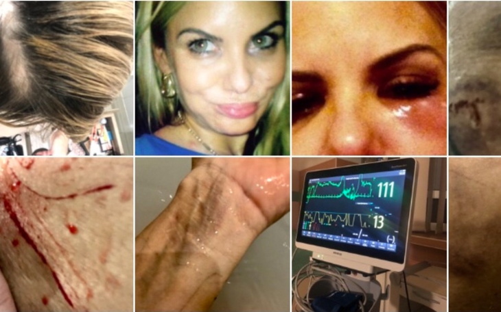 Zbiórka Ratowanie życia i bezdomnosci - zdjęcie główne