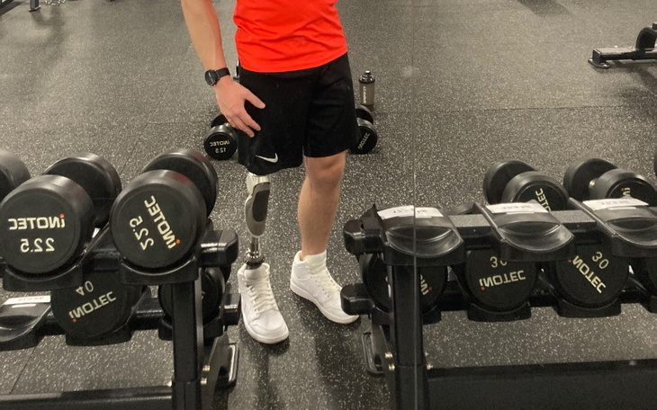 Zbiórka Pomóż Rafałowi proteza bez bólu - zdjęcie główne