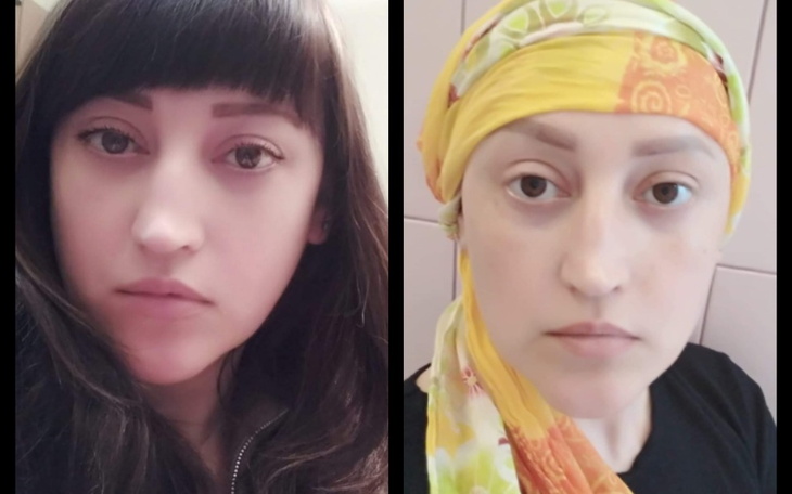 Zbiórka Dla leczenie Iryna - zdjęcie główne