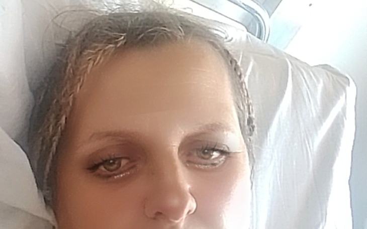 Zbiórka Nowotwór kręgosłupa nerkowe guzy - zdjęcie główne