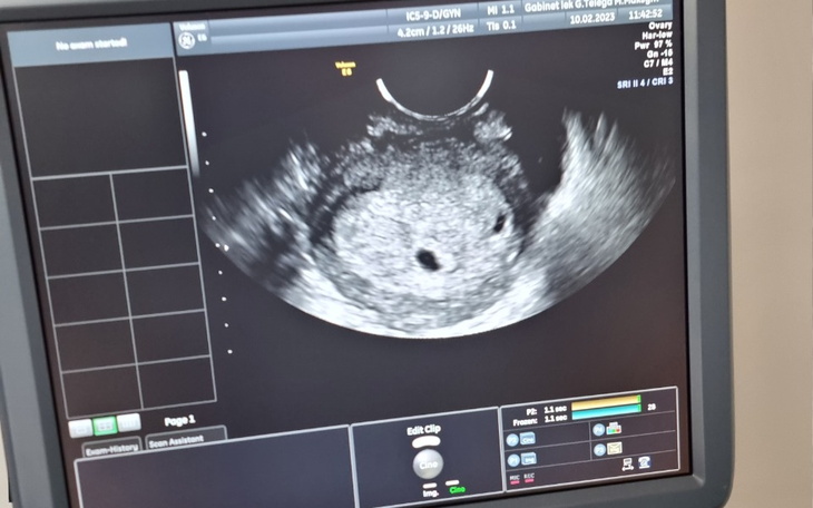 Zbiórka Ciąza dla zony cudzoziemki - zdjęcie główne