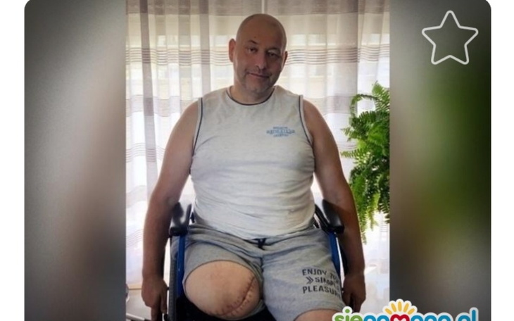 Zbiórka Zbieram na protezę nogi prawej - zdjęcie główne