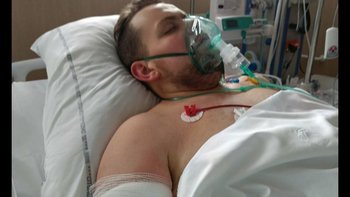 Zbiórka 22-letni Szymon walczy o życie! pilnie potrzebna pomoc! - miniaturka zdjęcia