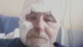 Zbiórka Rak penisa i pożar domu - miniaturka zdjęcia