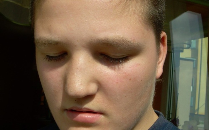 Zbiórka Leczenie Dawida - zdjęcie główne