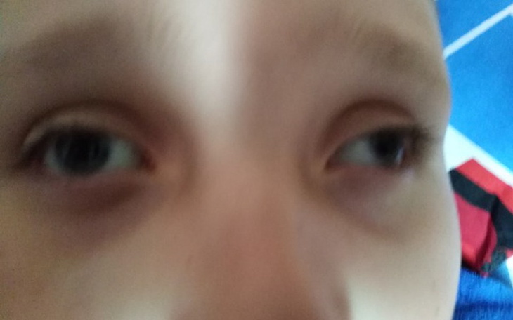 Zbiórka Zdrowe oczka - zdjęcie główne