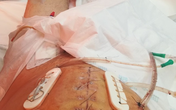 Zbiórka Tracę już siły. Pomóżcie proszę - zdjęcie główne