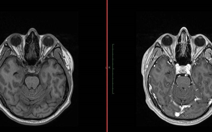 Zbiórka na sluchawki dla dziada - zdjęcie główne