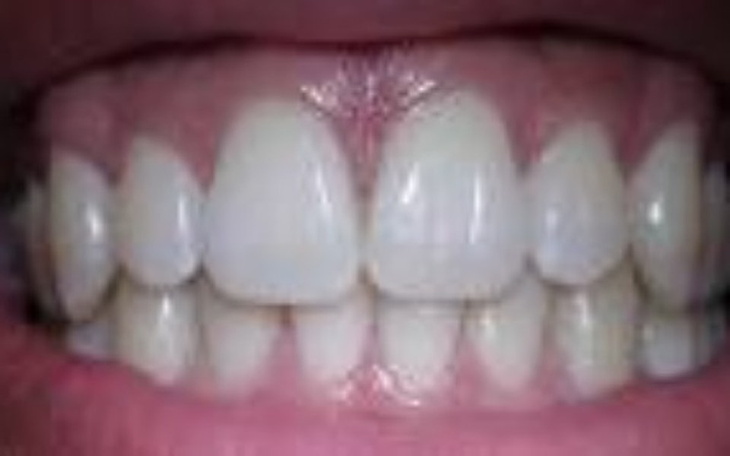 Zbiórka o ucha do ucha - zdjęcie główne