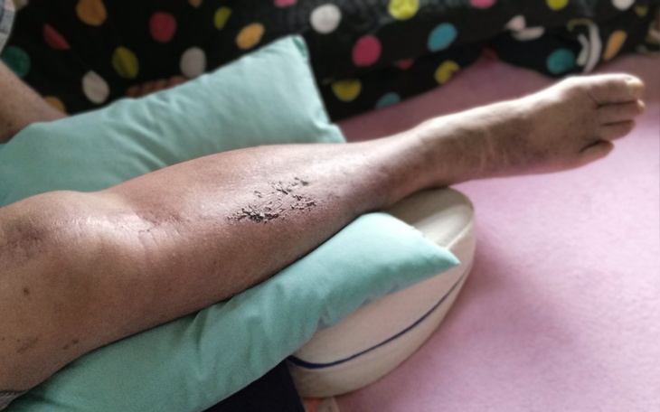 Zbiórka Aby uratować nogę.. - zdjęcie główne