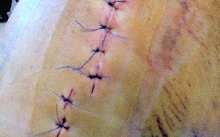 Zbiórka Rehabilitacja po potrąceniu - zdjęcie główne