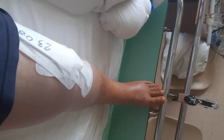 Zbiórka Rehabilitacja po operacji endopr - zdjęcie główne