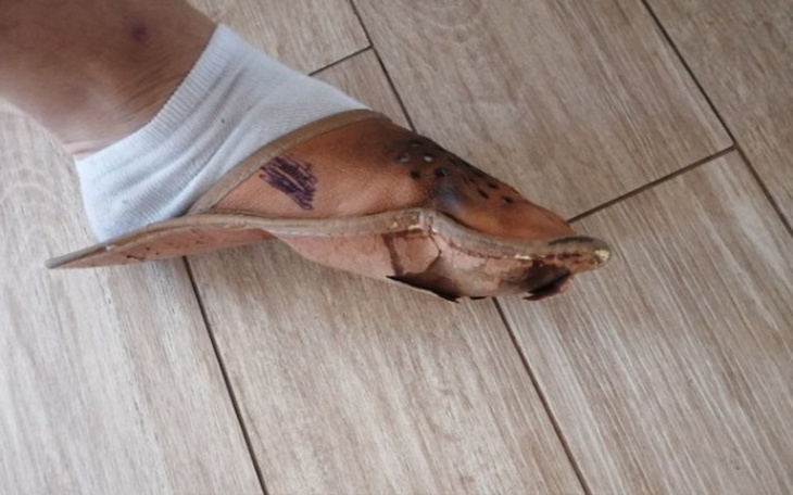 Zbiórka Na prestiżowe kapcie dla kolegi - zdjęcie główne