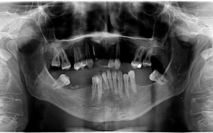Zbiórka Leczenie zębów i proteza - zdjęcie główne
