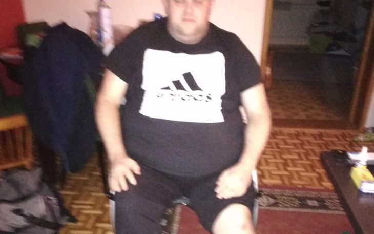 Zbiórka Na proteze nogi - zdjęcie główne