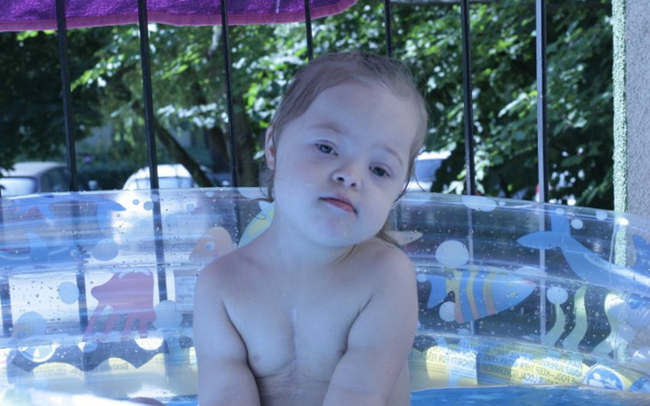 Zbiórka Lepszy rozwoj i rehabilitację co - zdjęcie główne