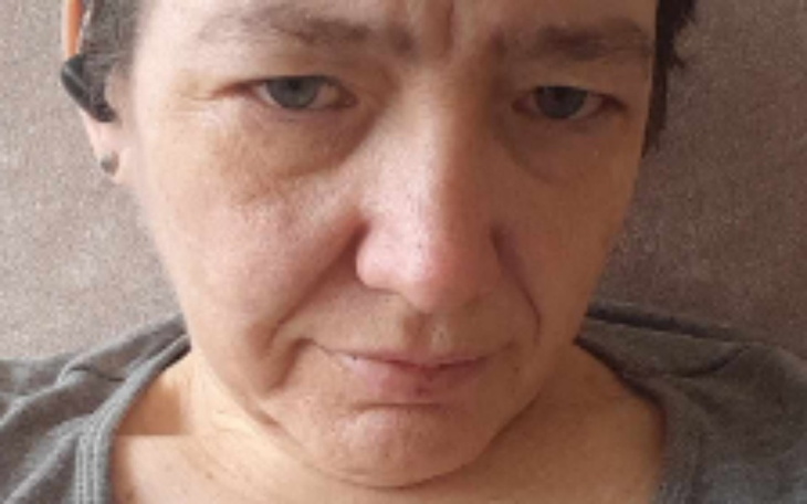 Zbiórka Niepełnosprawność, na życie - zdjęcie główne