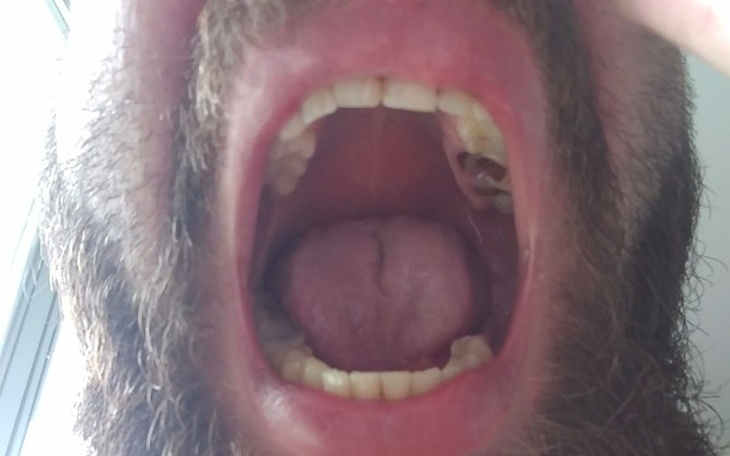 Zbiórka Na uśmiech, na zęby. - zdjęcie główne