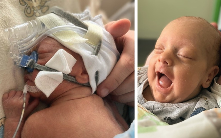 Zbiórka Zdrowie Maksia - zdjęcie główne