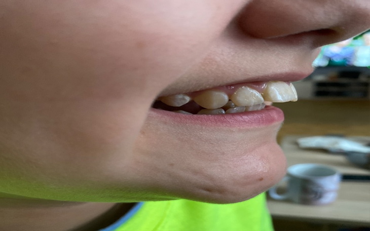 Zbiórka Leczenie zgryzu córki - zdjęcie główne