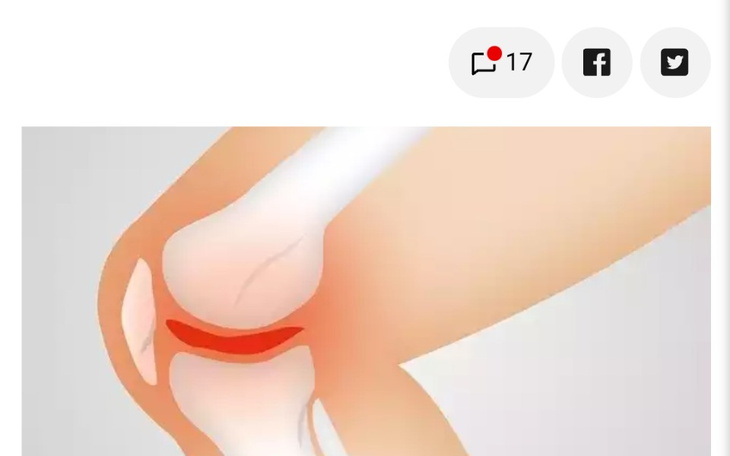 Zbiórka Operacja kolan potrzebne wsparci - zdjęcie główne