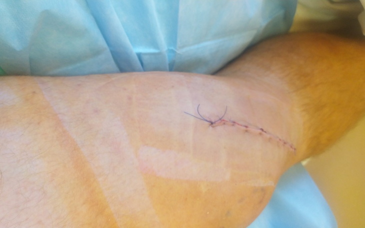 Zbiórka Po operacji na rehabilitacji - zdjęcie główne