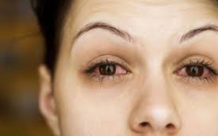 Zbiórka Operacja poprawy wzroku - zdjęcie główne