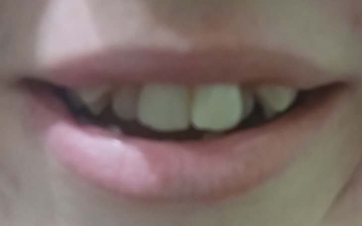 Zbiórka Na usmiech - zdjęcie główne