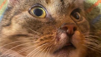 Zbiórka Tomograf dla Mani - miniaturka zdjęcia