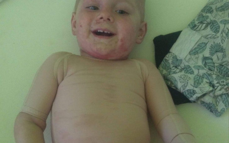 Zbiórka Na leczenie syna po wypadku - zdjęcie główne