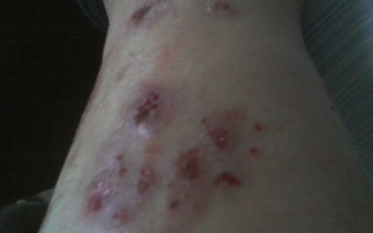 Zbiórka na leczenie i pokrycie badań - zdjęcie główne