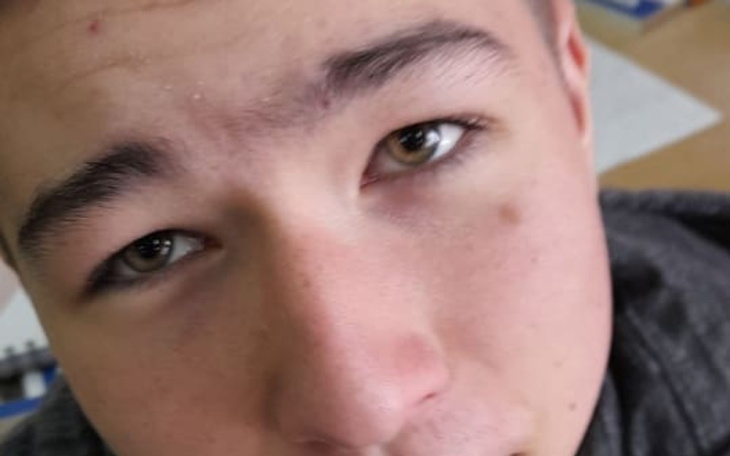 Zbiórka dla dawidka na nową fife - zdjęcie główne