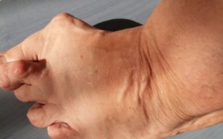 Zbiórka Wołanie o pomoc. - zdjęcie główne